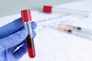 eparina.com | Chemioterapia ed eparina: il Khorana score fa la differenza